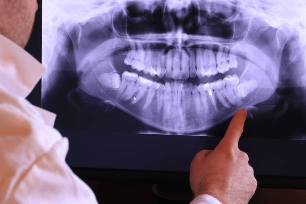 Best Cosmetic Emergency Dentistry in Cullman, AL