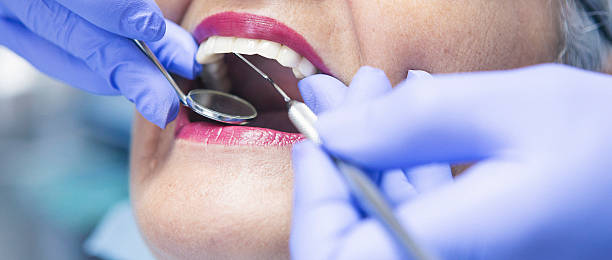 Best Emergency Treatment for Dental Infections or Abscesses in Cullman, AL
